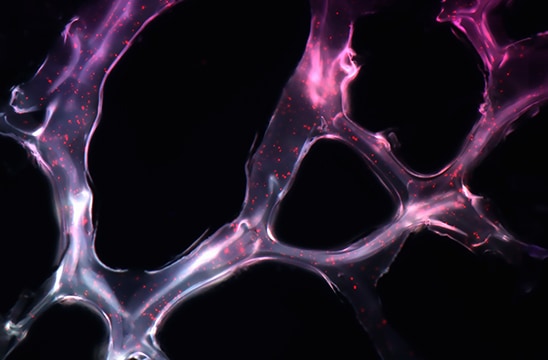 マウスモデルの乳癌ターゲットにマイクロ RNA を運ぶ、自己組織化ナノ粒子